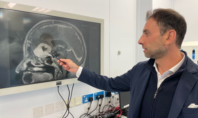 Έλληνας νευροχειρούργος αφαιρεί όγκους στον εγκέφαλο μέσω των φρυδιών - «Αισθάνθηκα υπέροχα»