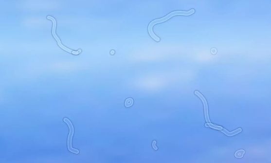 Ειδικός εξηγεί τι πρέπει να κάνετε αν αρχίσετε να βλέπετε αυτά τα σημάδια στα μάτια σας