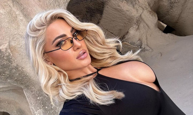 Ατύχημα για την Ιωάννα Τούνη - «Κάηκα μόνη μου και κάνω θεραπείες»