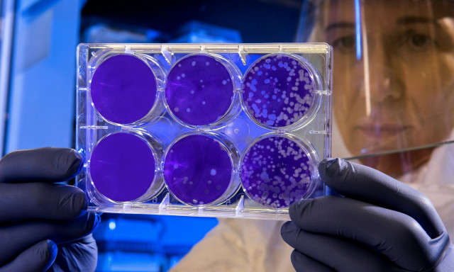 Οι επιφυλάξεις των επιστημόνων για τον γενωμικό έλεγχο 100.000 νεογνών στην Ελλάδα