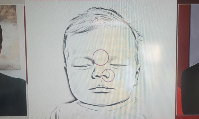 Ειρήνη Μουρτζούκου: Ντοκουμέντο από το νεκρό βρέφος της Κατερίνας - Εδώ είναι τα σημάδια στο πρόσωπο