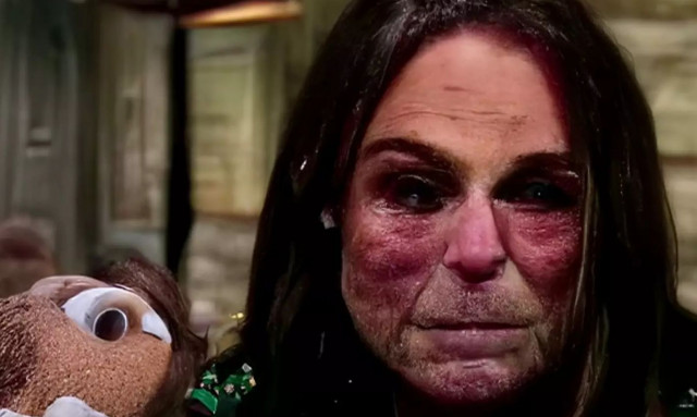 Το τρομακτικό πρόσωπο που στοιχειώνει το διαδίκτυο είναι μια γυναίκα που ονομάζεται «Loab»