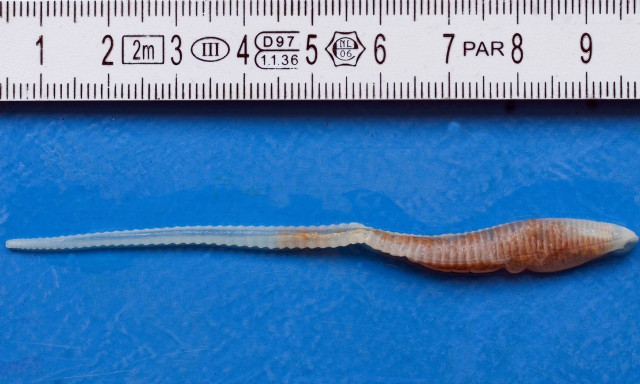 Συναγερμός για την ασθένεια σκουληκιών που ρουφούν το αίμα - Προκαλούν ακόμα και τύφλωση