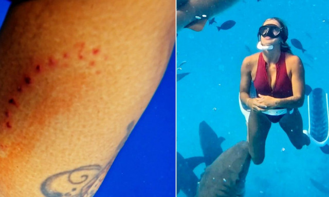 Τρομακτικό βίντεο: Καρχαρίας δαγκώνει το πόδι influencer - 18 εκατομμύρια προβολές