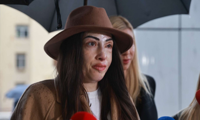 Ιωάννα Παλιοσπύρου: Ακόμα και σήμερα η γυναίκα που μου έριξε βιτριόλι με κοιτάζει στα μάτια