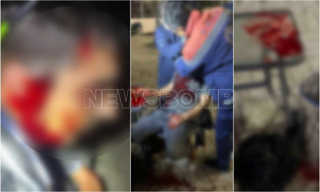 Αιματηρή συμπλοκή στο Μενίδι: Βγήκαν μαχαίρια και μπουκάλια – Δύο τραυματίες στο νοσοκομείο