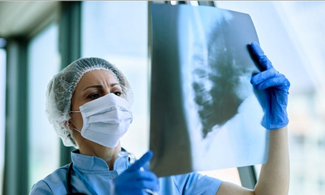 Τα «βήματα» για να νικήσουμε τον καρκίνο του πνεύμονα