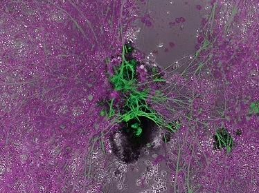 Ούτε νεκρός, ούτε ζωντανός: Επιστήμονες ανακάλυψαν «τρίτη κατάσταση» πέρα από ζωή και θάνατο