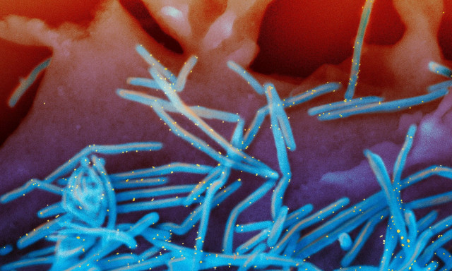 Αλτσχάιμερ: Ένας κοινός ιός μπορεί να ταξιδέψει στον εγκέφαλο και να συμβάλλει στη νόσο