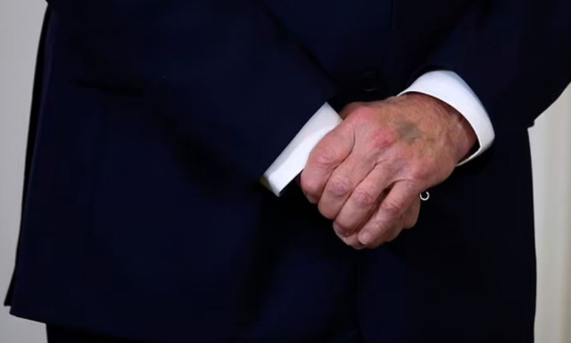 Κάτι τρέχει με τον Μπάιντεν: Το μυστηριώδες σημάδι στο χέρι του που προκαλεί ανησυχία