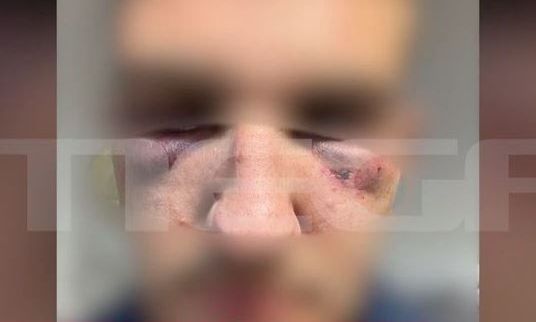 Κέρκυρα: Η περιγραφή του 17χρονου για την επίθεση που δέχθηκε από 15 συνομιλήκους του