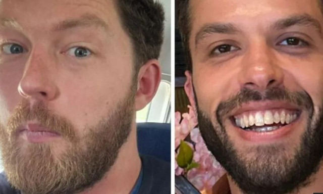 Ιταλία: Βρέθηκε νεκρός ένας από τους δύο πεζοπόρους που αγνοούνταν στους Δολομίτες