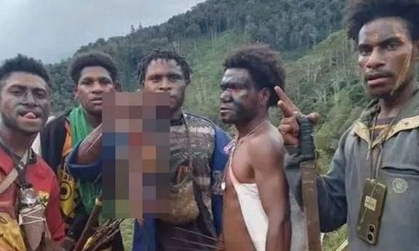 Γουινέα: Κανίβαλοι μαχητές βγάζουν selfies γλείφοντας κομμένα μέλη - «Αυτό είναι το φαγητό μας»