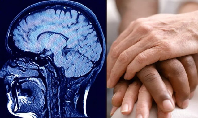 Επιστήμονες καταγράφουν τον ανθρώπινο εγκέφαλο καθώς κάποιος πεθαίνει και κάνουν απίστευτη αποκάλυψη