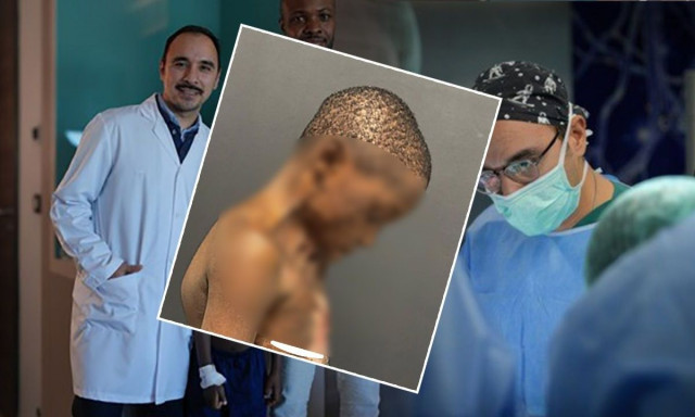 Νέα ζωή για 7χρονο μετά από ειδική επέμβαση: Είχε κολλήσει ο λαιμός του στο στήθος