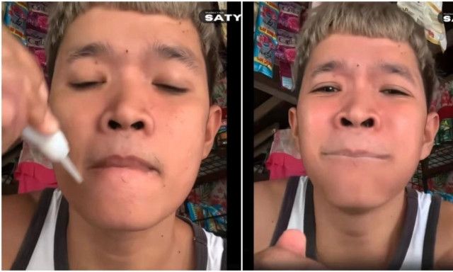 Φιλιππινέζος έκανε πείραμα με κόλλα και τα πράγματα δεν πήγαν όπως τα ήθελε