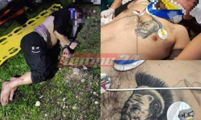 Πάτρα: Πώς η ΕΛ.ΑΣ. «έδεσε» τον δράστη του ξυλοδαρμού στον 45χρονο- Γιατί από φίλοι έγιναν εχθροί