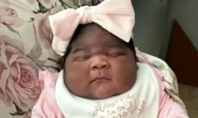 Απίστευτο και όμως αληθινό: Μητέρα γέννησε κοριτσάκι 6 κιλών - Τα τεράστια ρούχα που φοράει