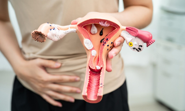 Ενδομητρίωση: Η νόσος-«χαμαιλέοντας» της γυναικολογίας που παραμένει υποδιαγνωσμένη