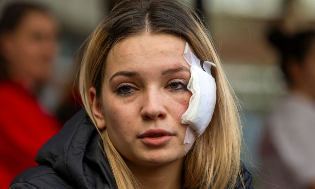 Σκόπια: «Είμαι νεκρός, έχασα το μοναχοπαίδι μου» - Ανατριχιάζουν οι μαρτυρίες από το κλαμπ