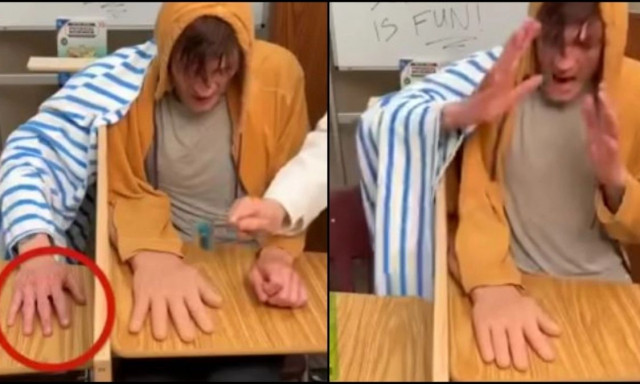 Το πείραμα με το «ψεύτικο χέρι» αποδεικνύει πώς μπορεί να εξαπατηθεί ο εγκέφαλος (βίντεο)