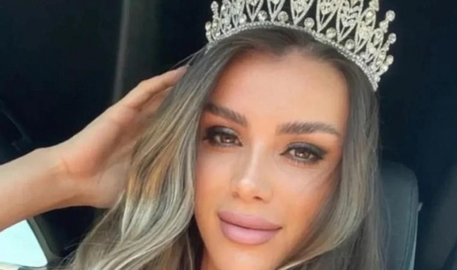 Γκιουλέρ Ερντογάν: Νεκρό σε τροχαίο το γνωστό 27χρονο μοντέλο