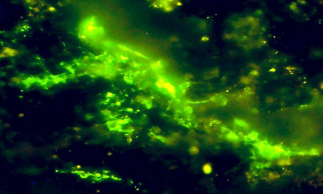 Αρχαία μικρόβια βρέθηκαν σφραγισμένα ζωντανά σε βράχο ηλικίας άνω των 2 δισ. ετών