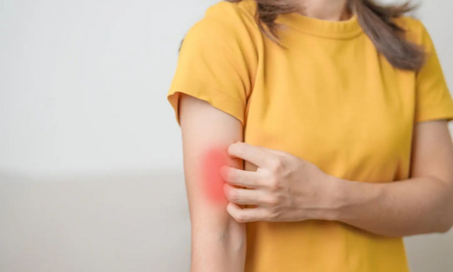 Γιατρός προειδοποιεί για την «μυστηριώδη ασθένεια» που προκαλεί μόνιμες βλάβες στα όργανα