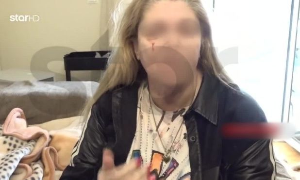 Κολωνός: Του ζήτησε να χωρίσουν και εκείνος την ξυλοκόπησε άγρια – «Τώρα θα δεις τι θα πάθεις»