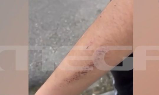 Νέα Φιλαδέλφεια: Σοκάρουν τα ντοκουμέντα από το άγριο bullying σε 12χρονο από 5 συμμαθητές του