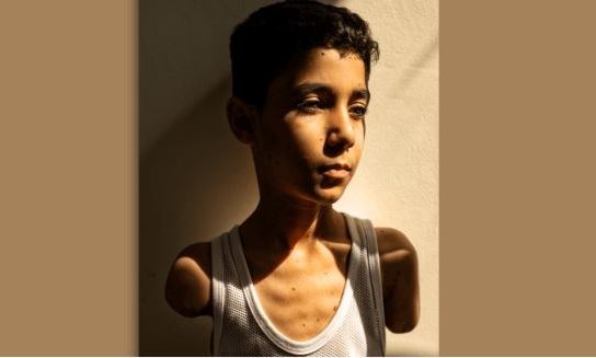 World Press Photo: Φωτό της χρονιάς o Παλαιστίνιος που έχασε και τα δύο του χέρια στη Γάζα