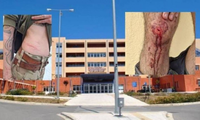 Ζάκυνθος: Λαθροκυνηγοί ξυλοκόπησαν ορνιθολόγους - Τους έστειλαν στο νοσοκομείο