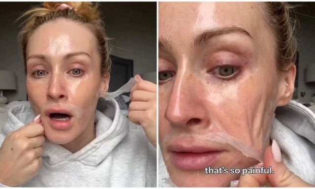 Σάλος με μάσκα «skincare»: Influencer «σφάδαζε» απ' τον πόνο κατά την αφαίρεση της (vid)