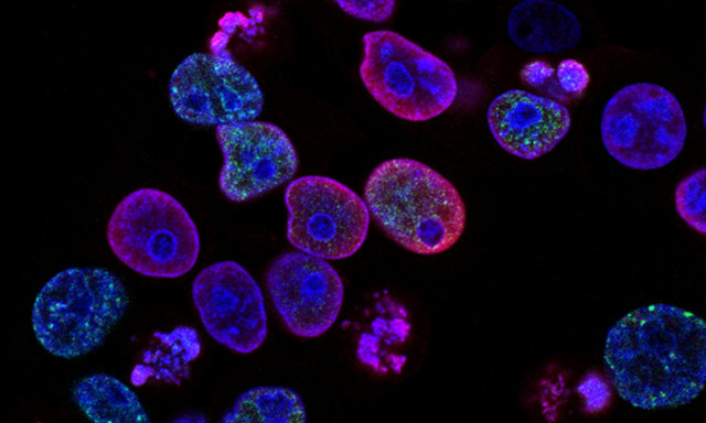 Επιστήμονες δημιούργησαν νανορομπότ που μπορούν να τροποποιήσουν τεχνητά κύτταρα