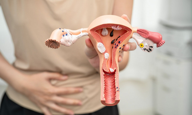 Καρκίνος του ενδομητρίου: Τα νεότερα δεδομένα και οι εξελίξεις στην αντιμετώπιση της νόσου