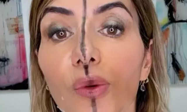 Γιατρός έκανε ένεση με μπότοξ στο μισό πρόσωπό της σε ένα πείραμα με σοκαριστικά αποτελέσματα