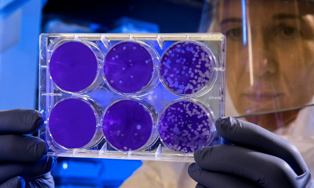 Σιωπηλός θάνατος στον αέρα που αναπνέουμε – Προειδοποίηση για τον Aspergillus