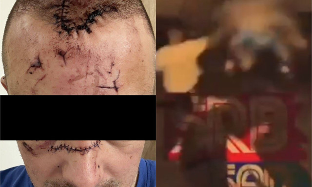 Η φωτογραφία του άνδρα που τραυμάτισε ο Κάρλικ Τζόουνς στη Σερβία