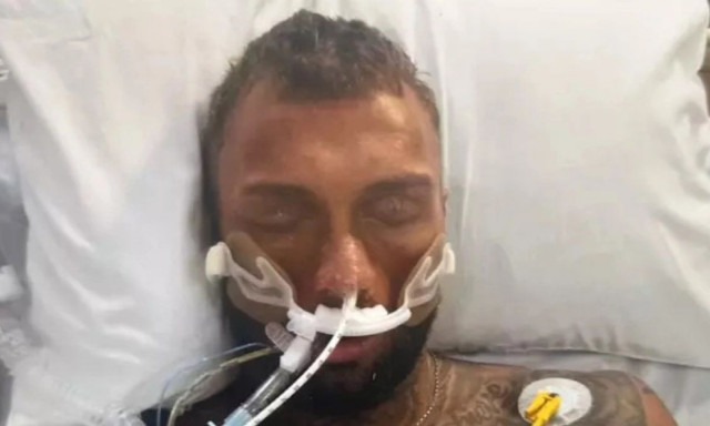 Η ψευδαίσθηση του 32χρονου bodybuilder που εθίστηκε στα στεροειδή