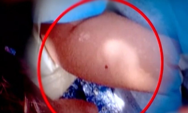 Λάρισα: Διαστάσεις απόλυτης φρίκης - Τι δείχνουν τα σημάδια με μαρκαδόρο στα σώματα των παιδιών