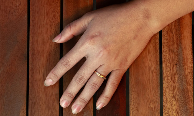 Αυτό το απλό τεστ με τα δάχτυλα σας μπορεί να δείξει αν θα γίνετε πλούσιοι