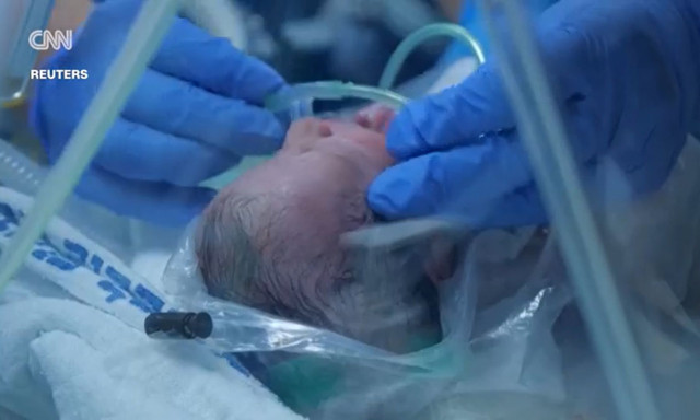 Ισραήλ: Γυναίκα γέννησε τρίδυμα την ώρα που το Ιράν βομβαρδίζει το Τελ Αβίβ