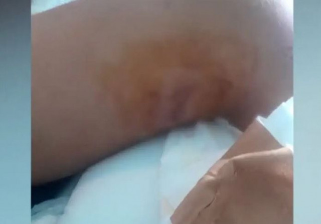 Πετρούπολη: «Είχε λιποθυμήσει και τον κλώτσαγαν στο πρόσωπο» - Τι λέει ο πατέρας του 15χρονου