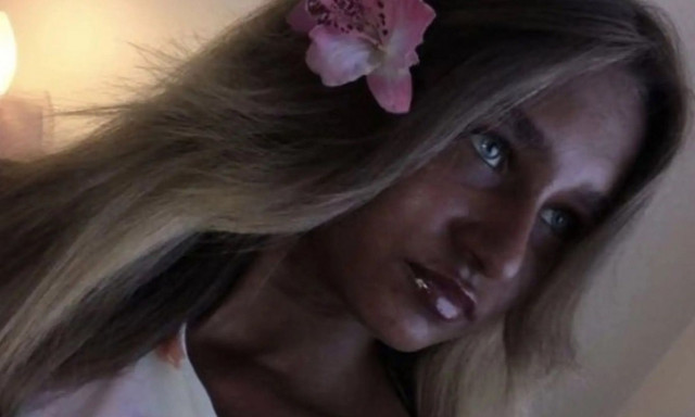 Αγνοώντας τους κινδύνους: 18χρονη εθισμένη στο μαύρισμα κοντεύει να γίνει σαν... κάρβουνο