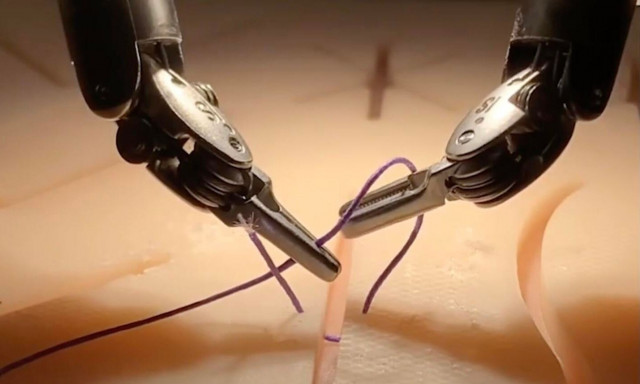 Ρομπότ εκτέλεσε από μόνο του χειρουργείο χοληδόχου κύστης με 100% ακρίβεια