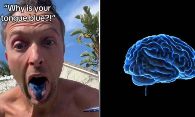 «Μπλε εγκέφαλος»: Γιατροί προειδοποιούν για το methylene blue - Tο φάρμακο του TikTok