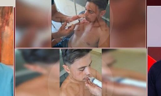 Βόνιτσα: 18χρονος ξυλοκοπήθηκε άγρια από ομάδα νεαρών - Του έσπασαν το σαγόνι, σιτίζεται με σύριγγα