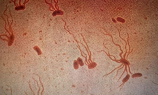 Βακτήριο -αρχαίος «δολοφόνος»- γίνεται γρήγορα ανθεκτικό στα αντιβιοτικά, προειδοποιεί μελέτη