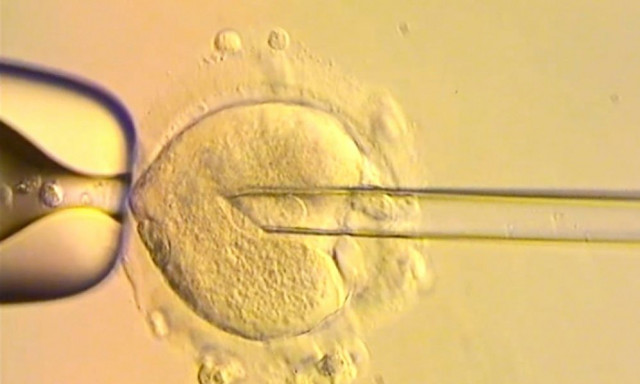 Βρετανία: Γεννήθηκαν μωρά με DNA τριών ατόμων - Είναι απαλλαγμένα από μιτοχονδριακά νοσήματα