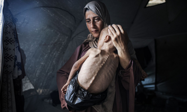 «Κόλαση επί Γης» τα νοσοκομεία στη Γάζα: Λιποθυμούν και οι νοσοκόμοι από την ασιτία